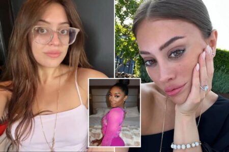 Exclusive | Simone Biles’ plastic surgery spotlights rise of women under 30 having major work done: ‘Seismic shift’