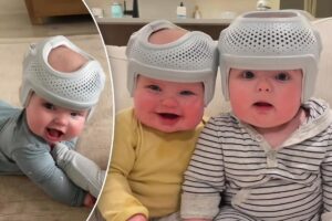My twin babies wear $700 helmets for 23 hours a day to reshape their flat heads — haters say I’m ‘crazy,’ but it’s for their own good