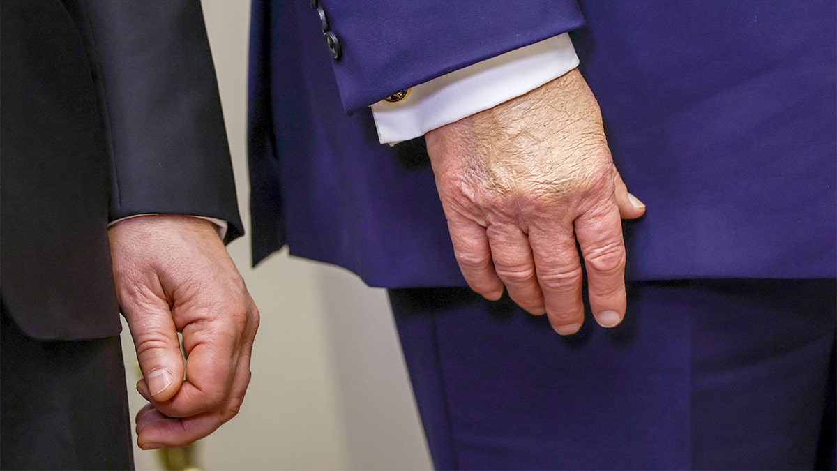 A close view focuses on the U.S. president’s hand as he gestures during a White House announcement.