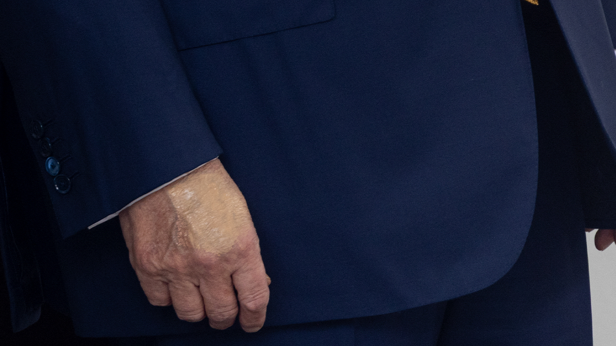 Trump's hands