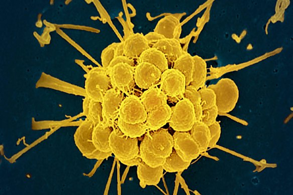 The Neisseria gonorrhoeae bacteria, which causes gonorrhea.