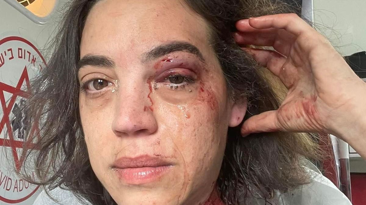 Michal Weits after being injured in an Iranian missile