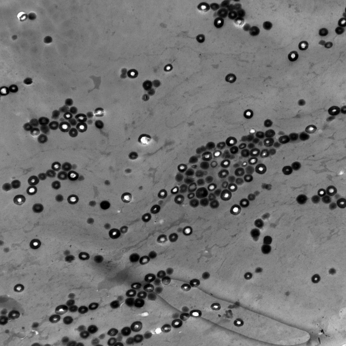 A 1,200-times magnification of a platypus's hollow, spherical melanosomes.