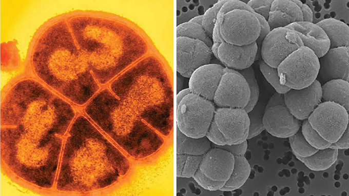 bacterium Deinococcus radiodurans (left) and microbe Methanosarcina barkeri (right).