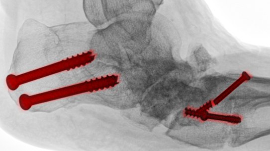 Podiatric surgeons can legally operate on patients, despite not having medical degrees.