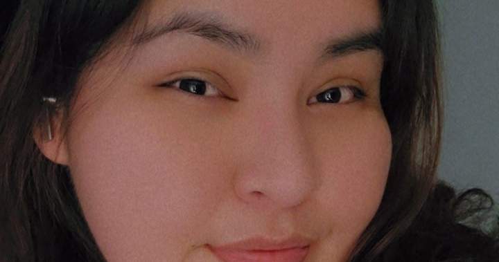 Family of woman who died in e-scooter accident pleads for riders to wear helmets