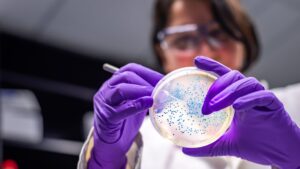 STEC bacteria in Victoria: Why health authorities are warning parents about petting farm risks