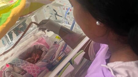 Logan couple welcome their baby daughter, Australia’s most premature newborn to survive