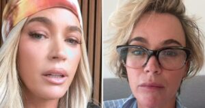 ‘RHOBH’ Alum Teddi Mellencamp Takes Off Her Wig, Shows Real Hair Amid Cancer Battle